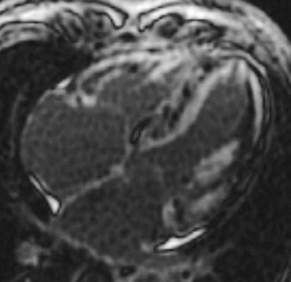 Cardiac CT course Rotterdam Erasmus CT cursus