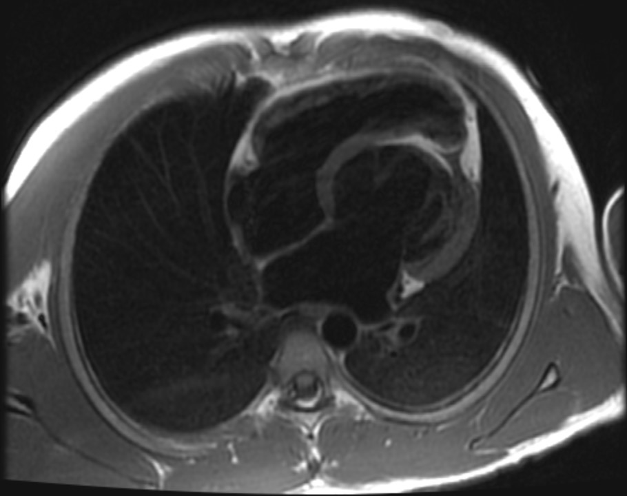 Cardiac CT course Rotterdam Erasmus CT cursus