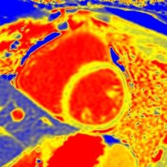 Cardiac CT course Rotterdam Erasmus CT cursus